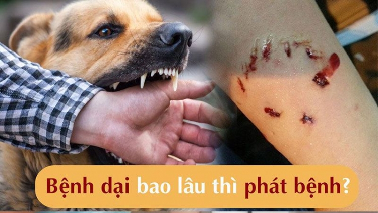 Pút đin pảnh kếu chaoz bùng tangz