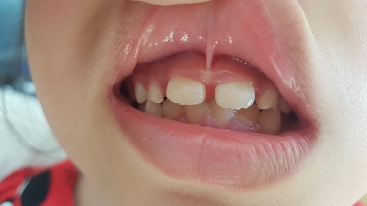 Zooi đoọng 1,5 tỷ đồng khám pa dưh cr’ay boop c’niêng ha p’niên k’tứi chr’hoong Bắc Trà My, tỉnh Quảng Nam