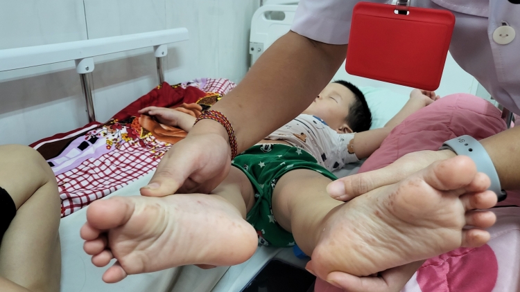 Ênoh hđeh ruă jơ̆ng kngan ƀăng êgei ktrŏ đĭ lu