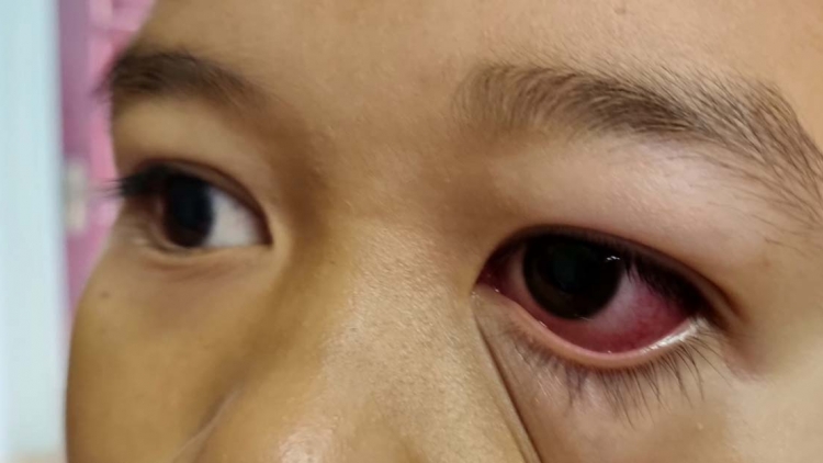 Kon Tum: Klei ruă ală hrah đĭ lar hlăm sang hră 