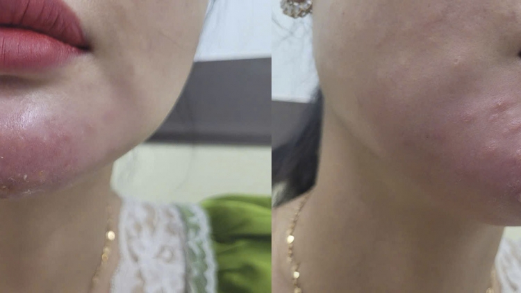 ពត៌មាន​ម៉ោង៦