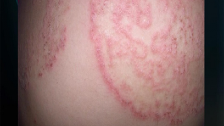 DOM KADHA BREI MBOH DI RUAK BIMAO KALIK 