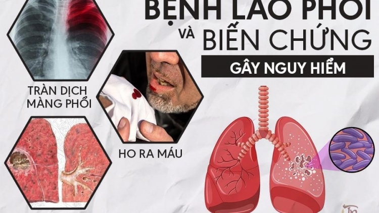 CR’AY A NGĂT LÂNG ĐÁI THÁO ĐƯỜNG