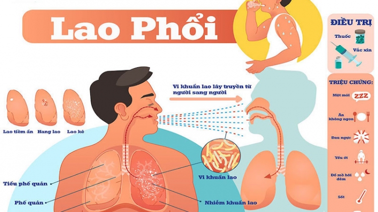 A NGẮT LÂNG HIV VÊY CHOOM PA DƯAH CĂH?