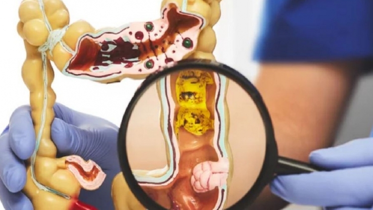 PILIH DUAH DAHLAU BREI MBOH THAU AWAL RUAK UNG THU GAH TUNG PRUAC