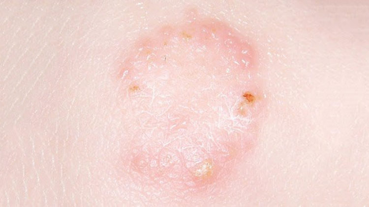 BREI THAU CAGA DAHLAU RUAK BIMAO DI KALIK KAYUA MBAK MENG ASAU MANGIU 