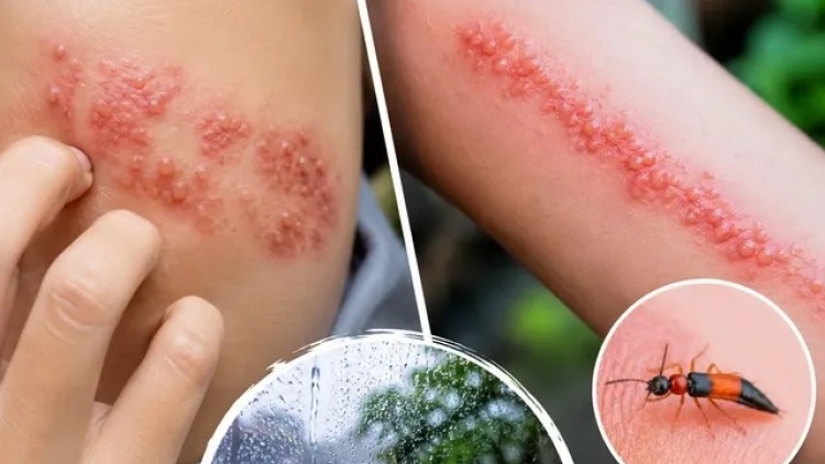 NDAIH MUN AIA, GANDUNG MERAH DI ANGAOK KALIK: NGAK YAU HABAR THAU  KAYUA ZONA ATAU DAM KLAU DANUAC?