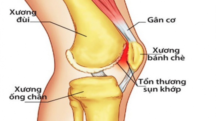 Pandik dom talang khớp ka-uh tuk melam