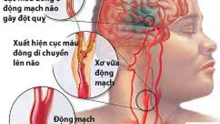 Zêl cha’groong lâng lêy bhrợ padứah bêl crêê tai biến c’lâng a’ham cóh a’bục