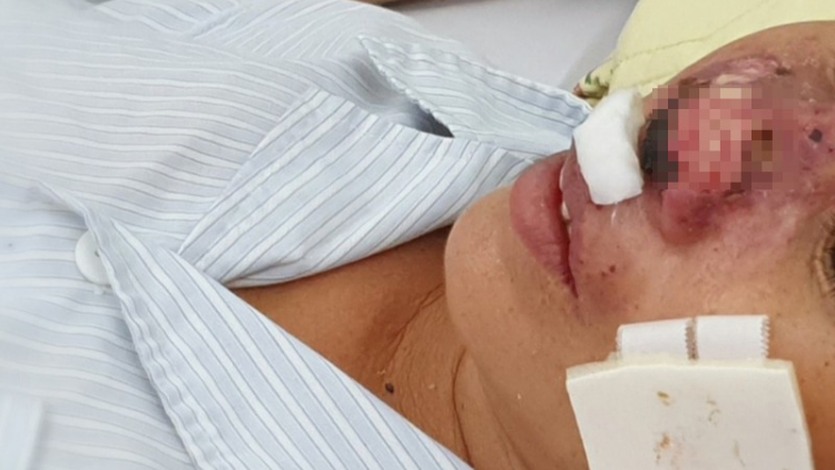 Pazêng rau xa nay lêy năl đăh cr’ay trơơi bọo ooy khuẩn đăh lệê ma nuýh-cr’ay trơơi bọo whitmore