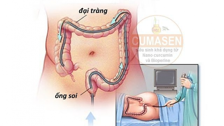 C’léh năl âng cr’ay đại tràng căh choom lơi