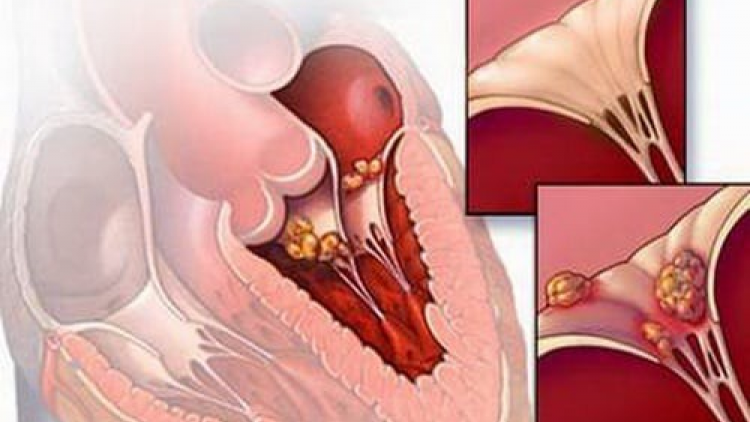 Cr’liêng xa nay cắh lalua ooy virus chrứih bhrợ viêm cơ da dưl