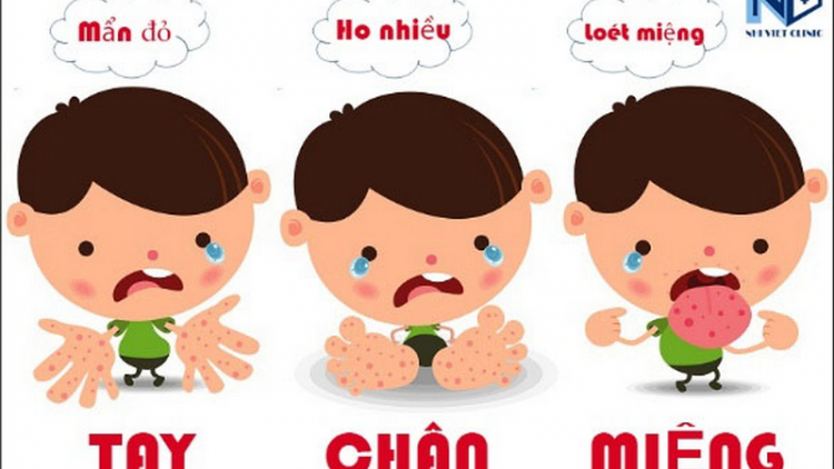 Cha groong cr’ay pr’đôm têy-dung-boop ha p’niên k’tứi coh trường học