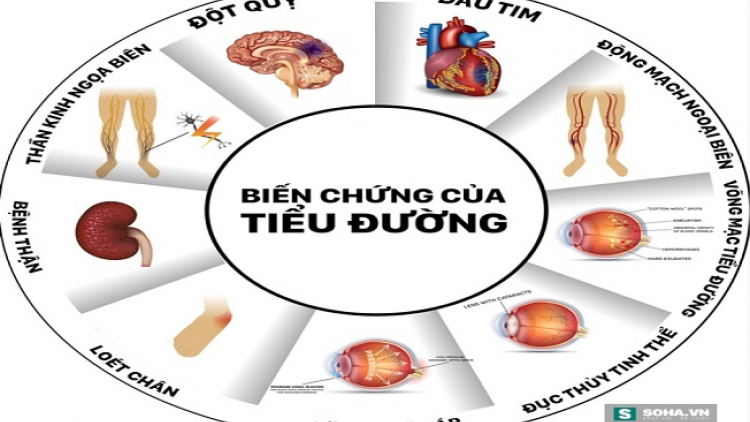 Nải vả kếu chaoz vả duấn pẻnh púng vìa pẹ