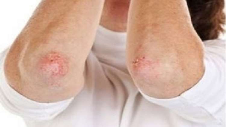 Tzía nhủng pảnh lẩu pút ziêm thóng hạ cuối kếu chaoz bùng tangzPảnh ziêm đốp