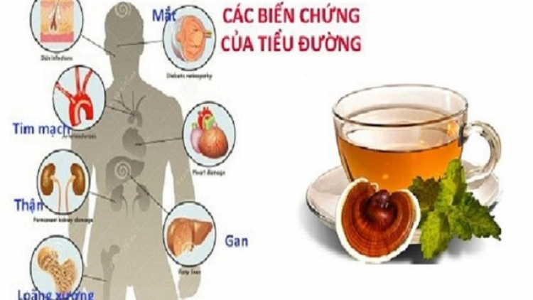 Pảnh púng vìa pẹ