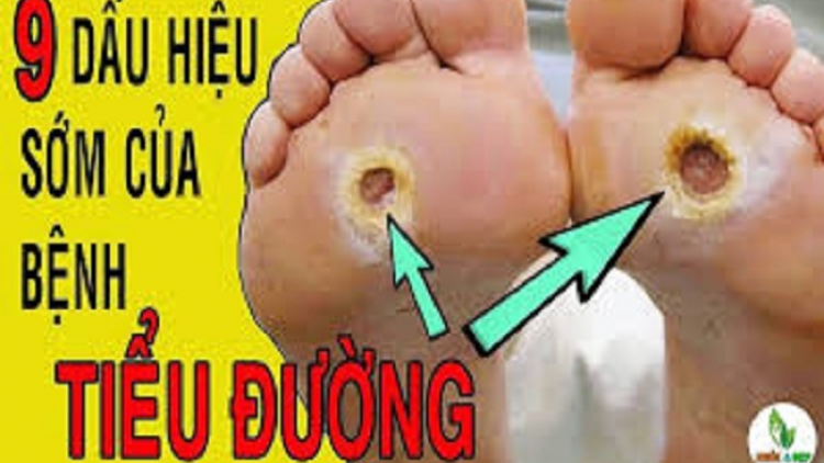 Bùng tangz pảnh púng vìa pẹ hangz hái?