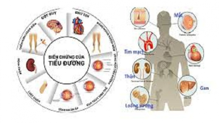 Puổn thamz Việt Nam miền máy hiuz bua pút pảnh púng vìa pẹ