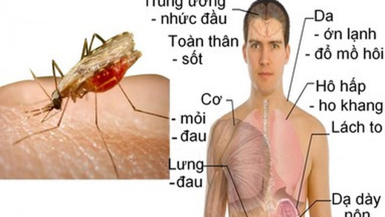 Việt Nam lo ngại sốt rét ngoại lai