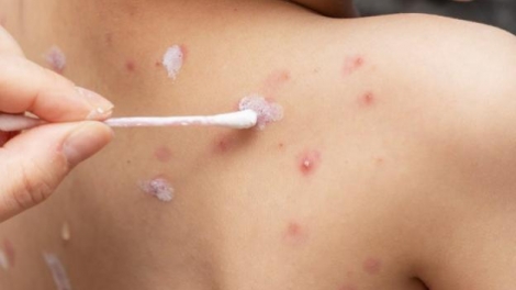 Đắk Lắk: Bơơn năl 2 zr’lụ pr’luh a duuc