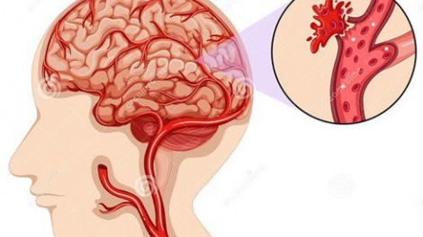 ĐỘT QUỴ SRAIY DARAH GLO AKAOK BREI THAU DAHLAU YAU HABAR? 