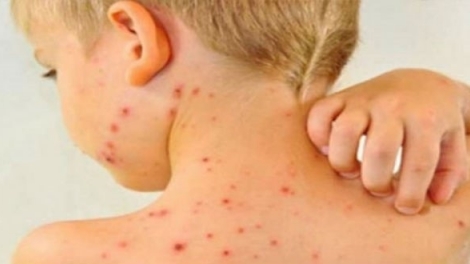 MBOH SAONG TAONG PADAM RUAK LAKA LAKAIH ANGAOK KALIK DI URANAIH