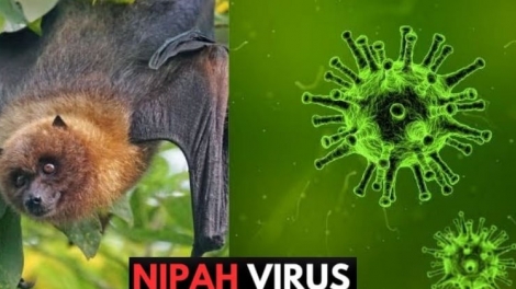 MENTRI Y TE SAMAR CHIP PANDAR PAGLAONG BRUK PASANG IEK VIRUS NIPAH DI PABAH MBANG NEGAR