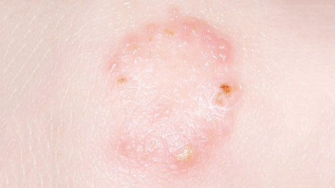 BREI THAU CAGA DAHLAU RUAK BIMAO DI KALIK KAYUA MBAK MENG ASAU MANGIU 