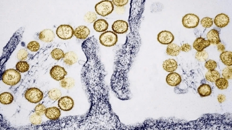 BỘ Y TẾ ĐƠƠH HÂN MOON PA RƠỚT VIRUS HANTA TRƠƠI TƠỢ AMÓ