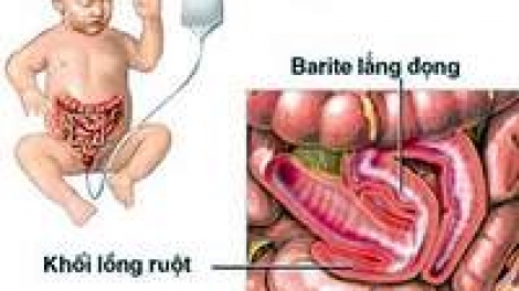 Iek ruak mblo hatung di uranaih