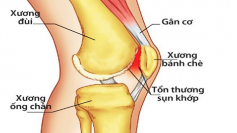 Pandik dom talang khớp ka-uh tuk melam