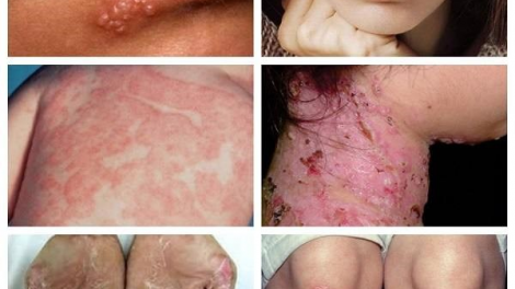 Việt Nam ắt cóh t’nooi nắc k’tiếc k’ruung vêy đợ manuýh crêê cr’ăy cóh n’căr bấc pa bhlâng cóh bha lang k’tiếc