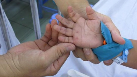 Quảng Ngãi: 1 cha nắc  p’niên cắh ma mông tu cr’ay têy dzung boóp độ 4