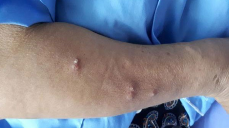 Vi khuẩn “đăh lệê ma nuýh” ting t’ngay ting bấc