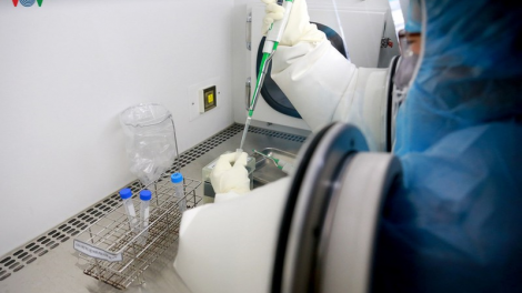 Bệnh viện Trung ương Huế nắc ơy tợơp xét nghiệm virus Corona