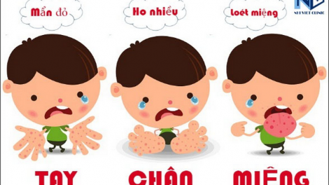 Cha groong cr’ay pr’đôm têy-dung-boop ha p’niên k’tứi coh trường học