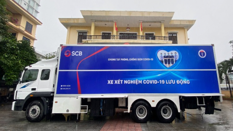 Ngân hàng Sài Gòn zooi xét nghiệm Covid-19 lưu động vêy chr’năp 15 tỷ đồng ha Thừa Thiên Huế