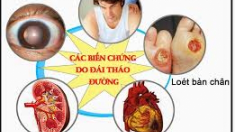 Tzụ quảng 7 tìu tỏng ziêm hít tzỏ pảnh púng vìa pẹ