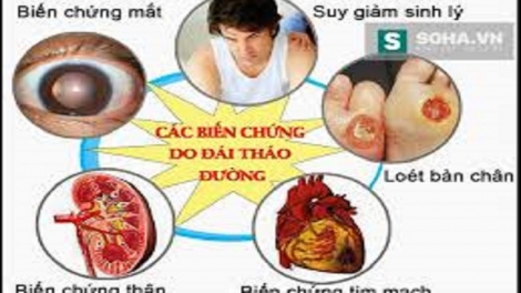 Chaoz tzỏ pẻnh púng vìa  pẹ lống hải ỳ tzản?​