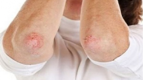 Tzía nhủng pảnh lẩu pút ziêm thóng hạ cuối kếu chaoz bùng tangzPảnh ziêm đốp