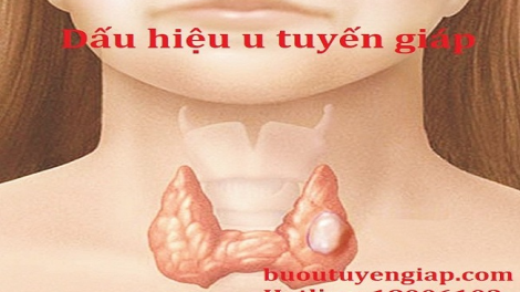 Tziaz tuz ung thư tuyến giáp hít thôz pút