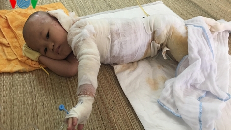 Chung tay cứu bé Triệu Thùy Nhâm