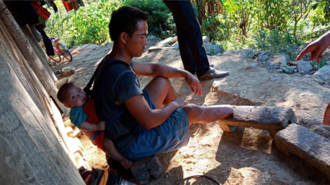 Cây đổ nghiền nát một chân người đàn ông Mông