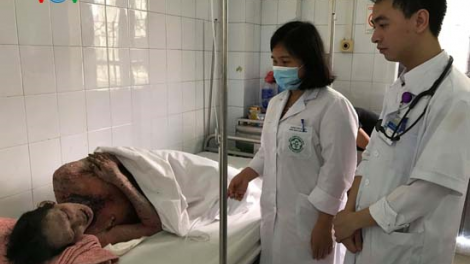 Bị bỏng a xít, người đàn ông dân tộc Dao biến dạng