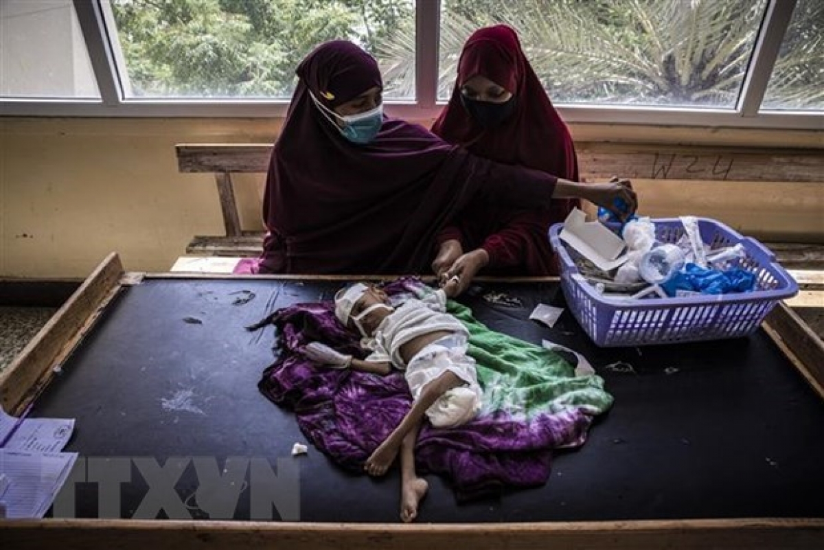 Nhân viên y tế điều trị cho em nhỏ bị suy dinh dưỡng tại bệnh viện ở Mogadishu, Somalia. (Ảnh: AFP/TTXVN)