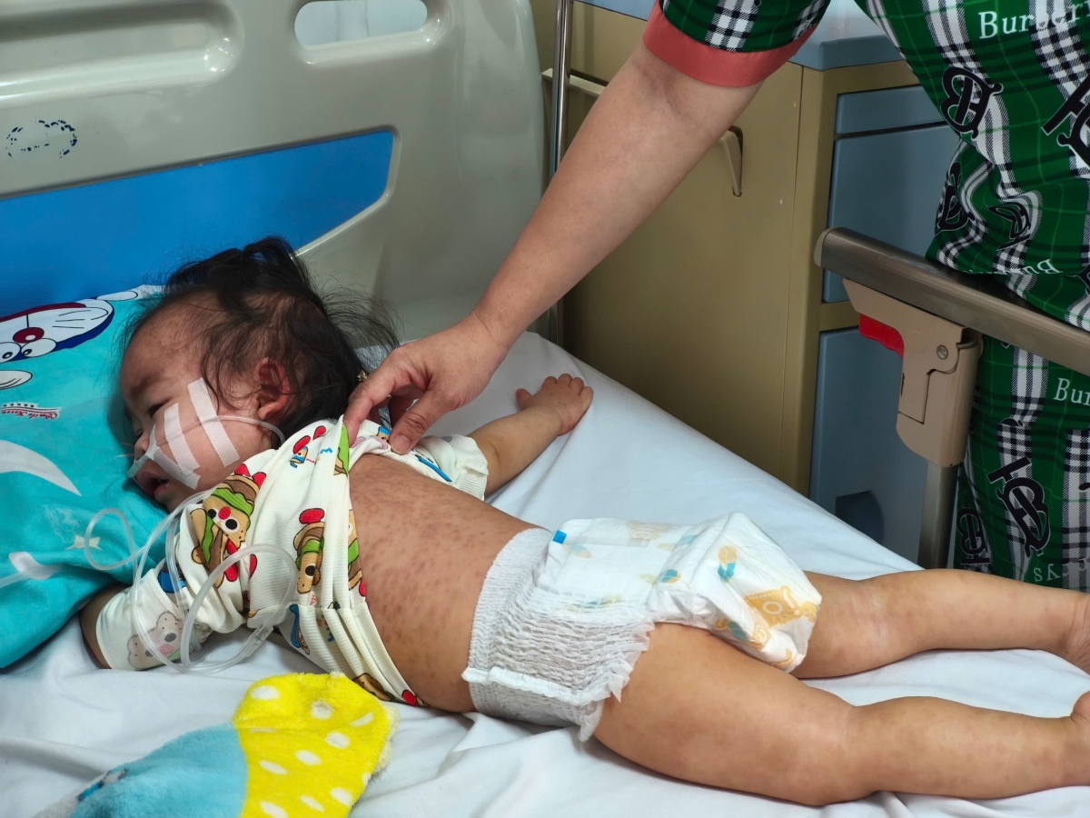 Sap apoăng hơnăm troh nôkố, lâp tơnêi têa tối ai lối 52.000 ngế lo sêi, ki hên cho vâi hdrêng