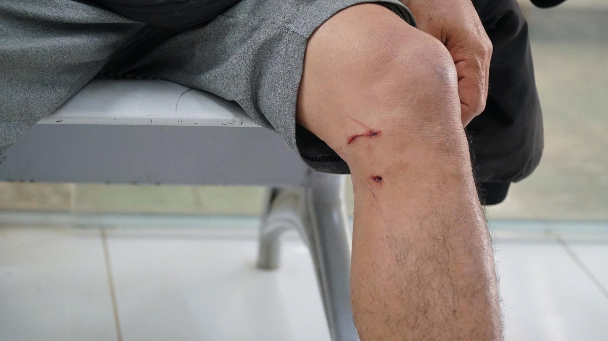 Drêng tro chó kâ, miếo kơpúa, kuăn pơlê thế ‘nâi túa pêi pro xếo  tro tơdroăng a hbáu chó kâ, miếo kơpúa pro tro tiô hnê mơhno dêi kơvâ ngăn pơkeăng