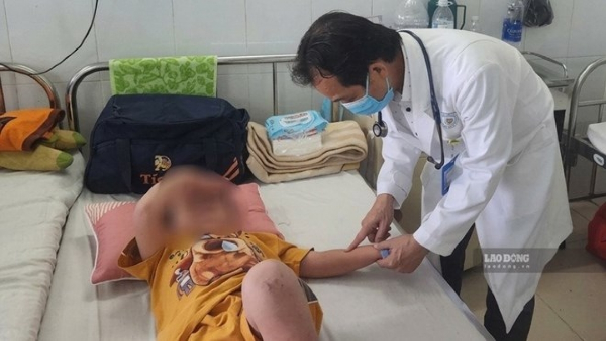 Trẻ mắc tay chân miệng được theo dõi, điều trị tại Bệnh viện Đa khoa Vĩnh Long. Ảnh: Hoàng Lộc