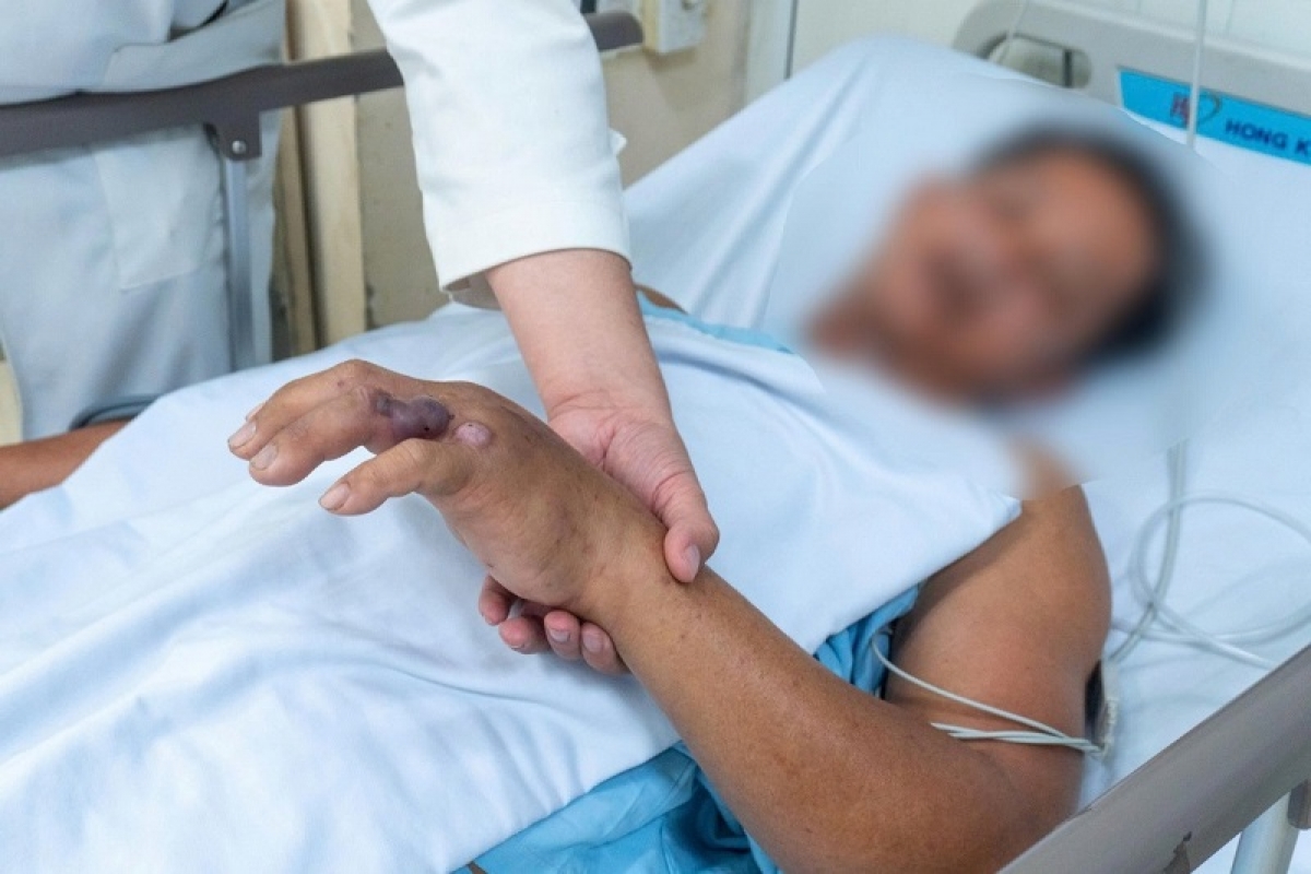 Sang iek ruak Quân y 120 jru dhit ruak ka urang gaok ula kaik